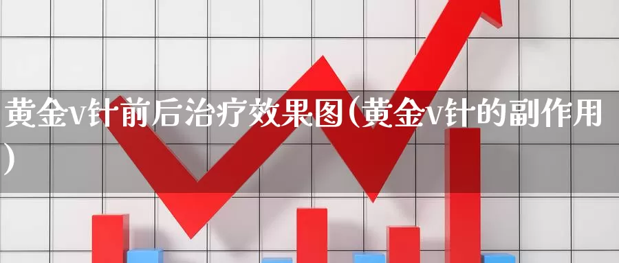 黄金v针前后治疗效果图(黄金v针的副作用)_https://www.zzcnk.com_财经_第1张